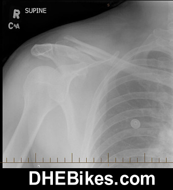 Click here to check out some x-rays!