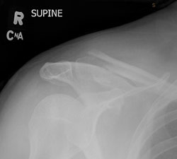 Click here to check out some x-rays!